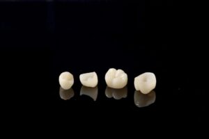 オールセラミック