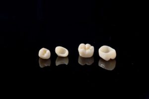 ジルコニアセラミック